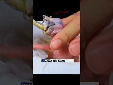 Pemuda ini Temukan Telur Aneh di Hutan