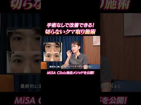 あなたのクマはどのタイプ？黒・茶・青クマ別の正しい治し方【脱脂の罠】
