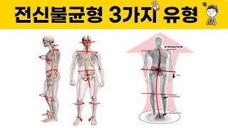 골반틀어짐은 곧 전신틀어짐! 흔한 체형불균형 유형 3가지 자세히 알아보기