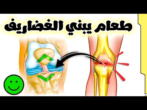 علاج خشونة المفاصل || تناول 5 أطعمه تبني طبقات غضاريف المفاصل