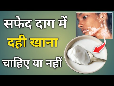 सफेद दाग में दही खाना चाहिए या नहीं | safed daag me dahi khana chahiye ya nahi