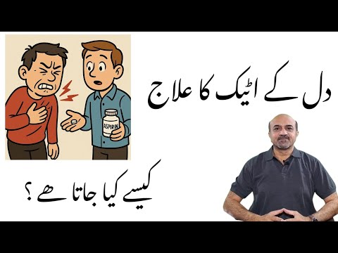 How Heart Attack Is Treated Step by Step | Stent, Bypass, Medications & Recovery Explained