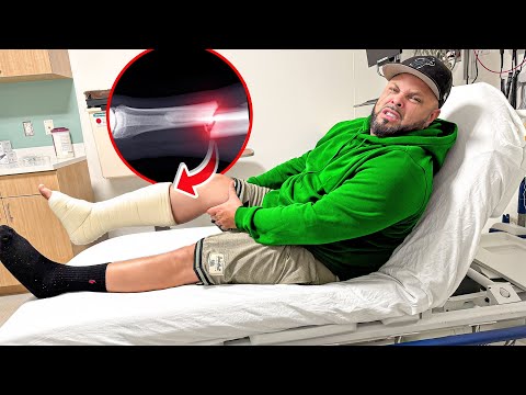 He Had A Very Scary Accident