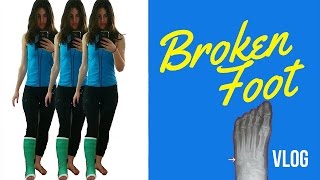 My Broken Foot Story (Positives)