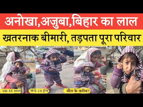 दुनिया का सबसे छोटा बच्चा,जो भयानक बीमारी से परेशान है🥺#viralvideo #siwan #viralboy #bihar #piyush