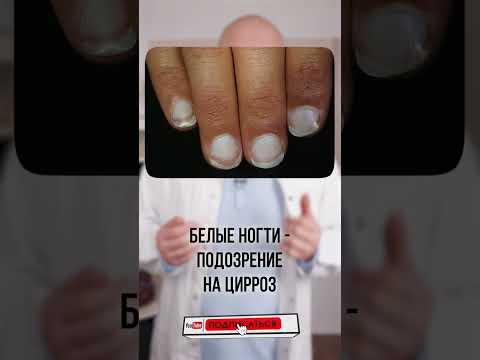 Проверь свои ногти! Диагностика по ногтям #shorts