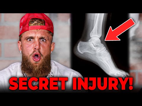 Jake Paul Reveals Secret Injury Before Mike Tyson Fight