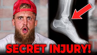 Jake Paul Reveals Secret Injury Before Mike Tyson Fight