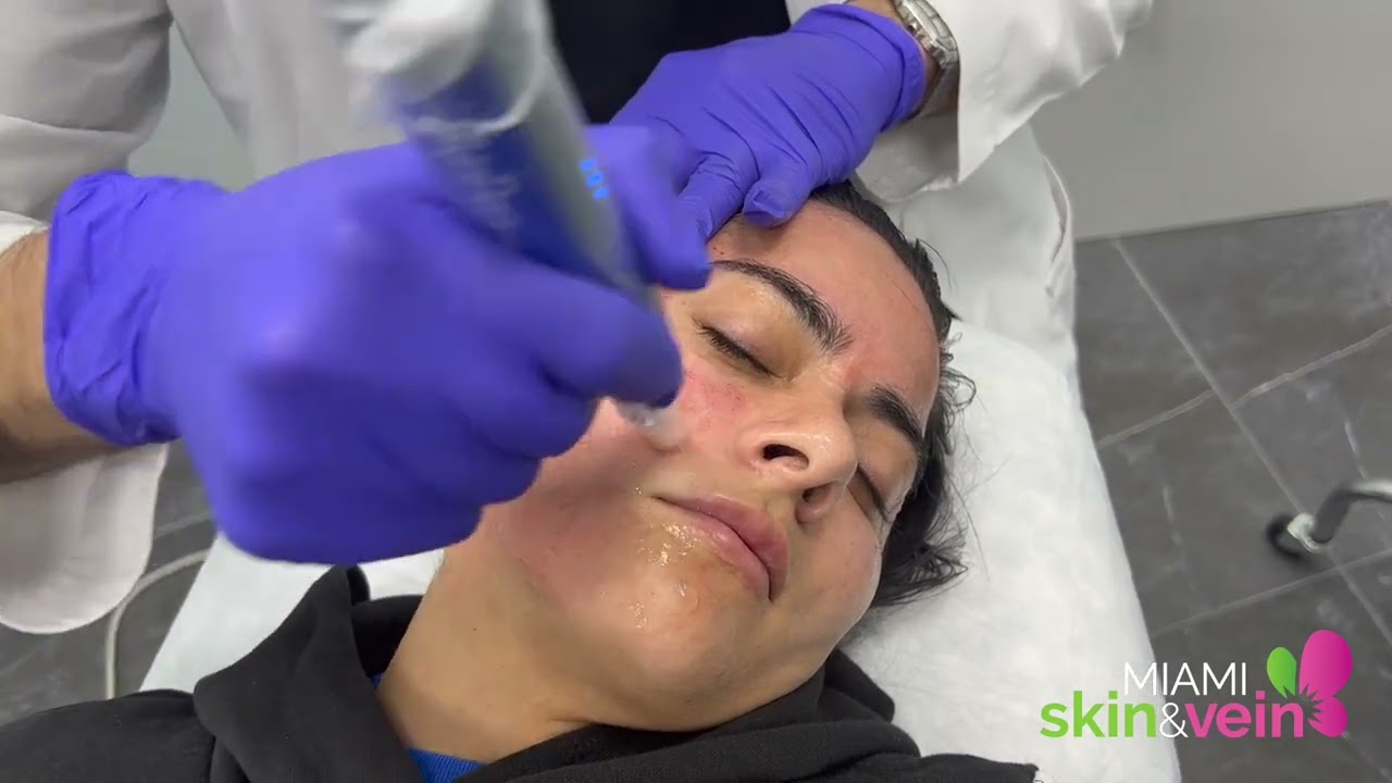 Woman with markings for cosmetic procedure preparation.