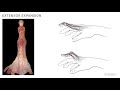Understanding Mallet Finger and Boutonniere Deformity