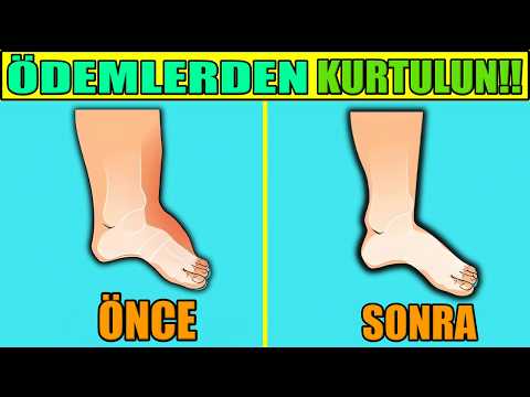 Vücudunuzdaki Birikmiş Ödemi ATMAK için Bu Videoyu İzlemelisiniz!!