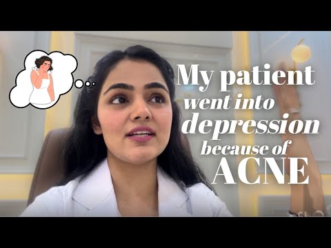 My patient went into depression because of ACNE 😥 @doctorduo