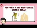 Kuis tentang Penyakit dan Kesehatan Sistem Gerak