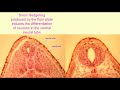 Sonic Hedgehog and Neural Development