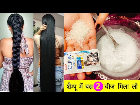 शैम्पू में सिर्फ दो चीज़ मिलाकर लगालो बाल 200 गुना तेजी से बढ़ेंगे Shampoo mein kya milakar lagaen