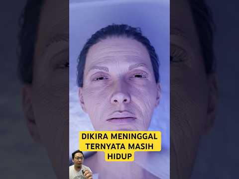 DIKIRA MENINGGAL TERNYATA MASIH HIDUP