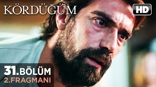 Kördüğüm 31. Bölüm 2.Fragmanı
