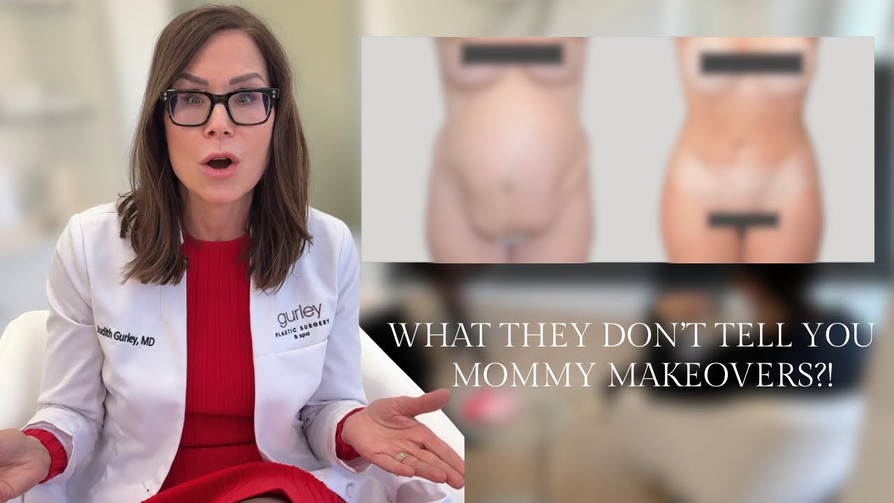 Doctor discusses mommy makeover insights and concerns.