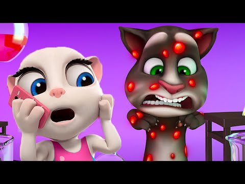 Talking Tom 🐱 Llama al doctor 🔥 Super Toons TV Dibujos Animados en Español