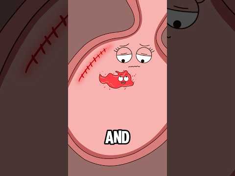 Why do women have to endure excruciating pain again after a cesarean section?#shorts #funny #hot