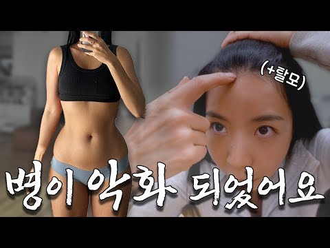 살찌는 병이 급격하게 악화 되었어요 (탈모는 덤) 살찐이 Vlog