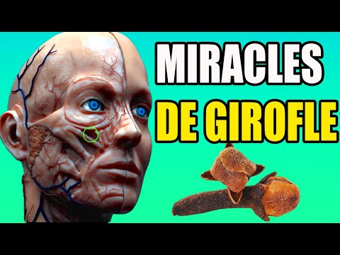 Pourquoi Manger Des Clous De Girofle Tous Les Jours ? Les miracles des clous de girofle sur la sante