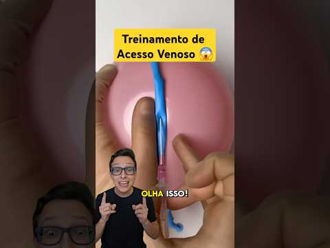 Desafio de Acesso Venoso 😱#medicina #medico #enfermagem #enfermeiro #enfermeira Acesso Periférico