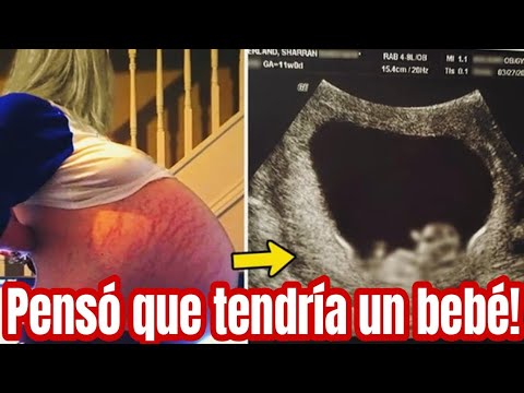 No era un Bebé lo que crecía en su vientre! Los médicos quedaron en shock al verlo.