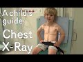 Understanding the X-ray Process