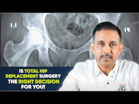 Is Hip Replacement Right for You? * DECIDING ON TOTAL HIP REPLACEMENT SURGERY *