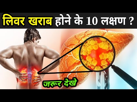 लिवर खराब होने के 10 लक्षण ? | Liver Damage Symptoms Hindi