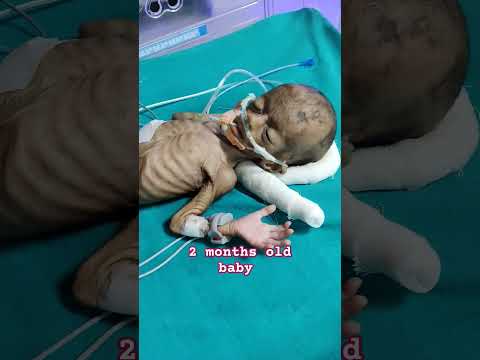 2 months old baby 🐥 Ghar pr  baby 😔k sath esi laprbahi 🥺na kre#nicucare #viralshort #baby #nicu