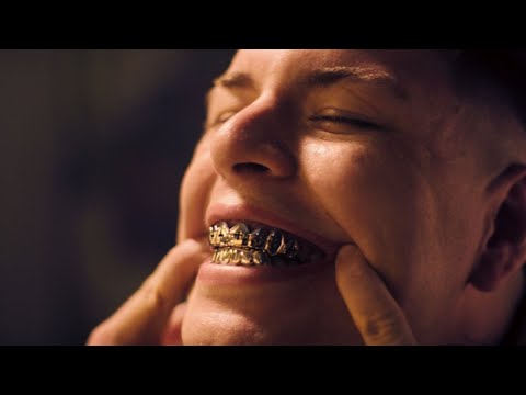 VIDA LUJOSA - KNAK | #POSITIVO