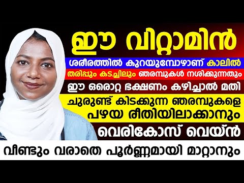 ഈ വിറ്റാമിന് ശരീരത്തിൽ കുറയുമ്പോൾ തരിപ്പും കടച്ചിലും വരും | വെരികോസ് വെയ്ൻ മാറാൻ
