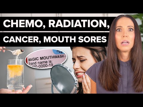 Mouth Sores from Cancer Treatment: Tips for Relief and Comfort