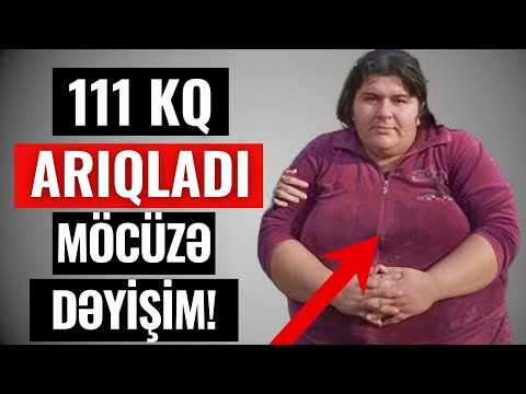 Azərbaycanlı Qadın 111 kiloqram ARIQLADI - Heç kəs onu tanıya bilmədi