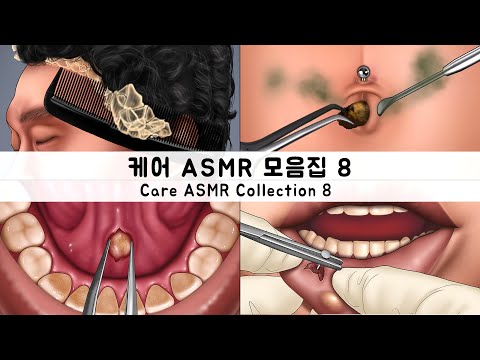 ASMR 케어 애니메이션 모음집8 배꼽 청소, 피어싱 제거, 타석증, 지루성 두피, 에어팟 청소 | CARE ANIMATION COLLECTION 8