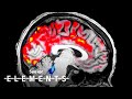 Understanding Sleep and Brain Health