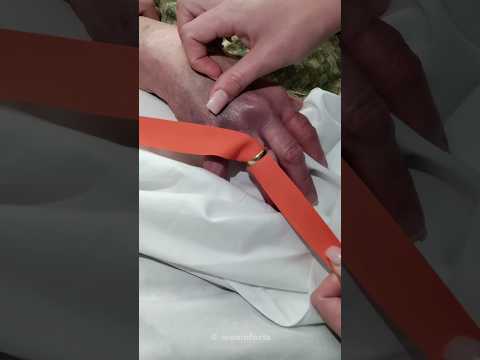 ഇത് കണ്ടിട്ടുണ്ടോ..?🤯🔥|Ring Removal from finger🥶🔥#shorts #amazingfacts  #ytshorts