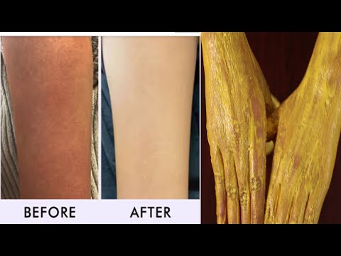 Clean hands and feet with curd in minutes - How to Clean Tan on Hands or Feet | Skin Whitening Re...