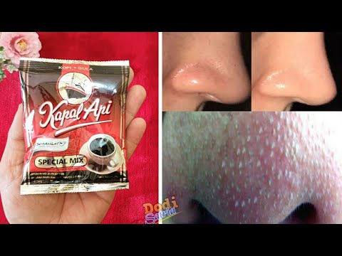 3 MENIT CARA AMPUH MENGHILANGKAN KOMEDO HIDUNG SECARA CEPAT
