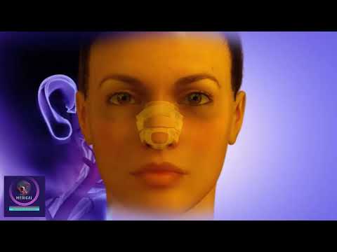 Rhinoplasty Surgery Animation - Nose Correction & Reshaping Procedure