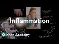 Understanding Inflammation and Its Implications