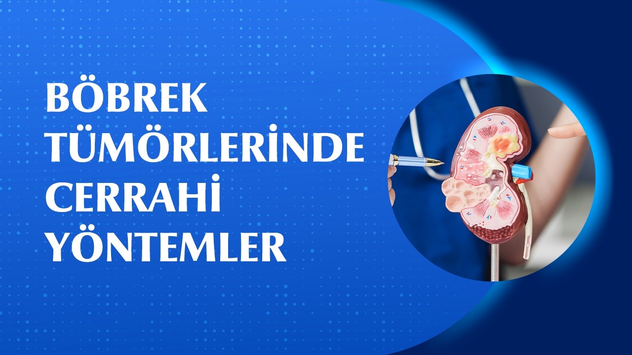 Böbrek Tümörü Belirti Vermeden İlerleyebilir mi? Nasıl Tedavi Edilir?