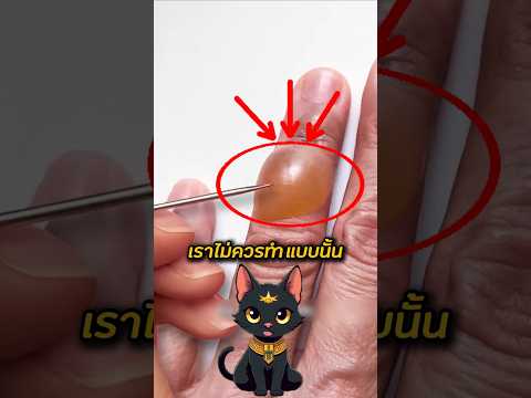 ห้ามทำแบบนี้เด็ดขาด! (ฉันเตือนแล้ว)