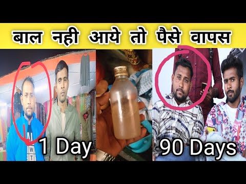 Best hair oil for hair growth part 2 | बाल नहीं आए तो पैसे वापस? 110% गारेंटी | hair growth oil