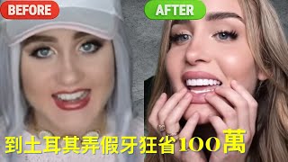 到土耳其弄假牙好擠啊。美國網紅透過TikTok到土耳其牙醫診所業配做20顆瓷貼片，省100萬台幣｜林榆芩牙醫師