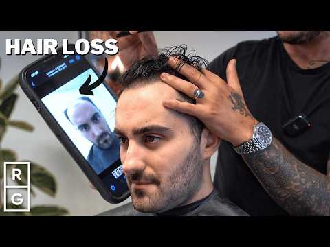 He Tried EVERY Treatment for HAIR LOSS (Transplant, Medication, Hair System) | Talking Hair Loss S2