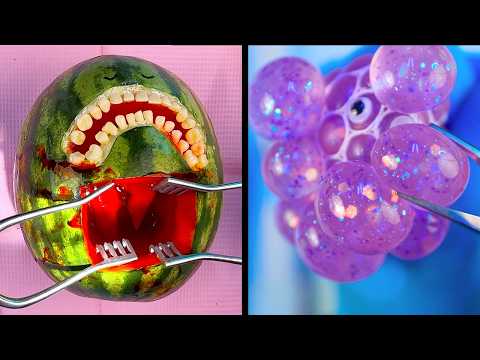 Food Surgery C-Section Compilation- Sad Emergency Fruit Surgeries | Discount Dentist TikTok Series