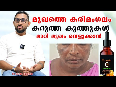 രാത്രി കിടക്കുന്നതിന് മുമ്പ് ഇത് രണ്ടുതുള്ളി മുഖത്ത് പുരട്ടി കിടന്നുറങ്ങിയാൽ /Dr Varun Nambiar